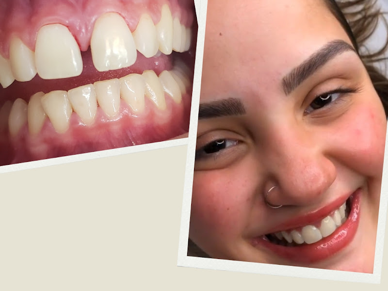 Foto 10 de Cavasi Clínica Odontológica - Dentistas em Juíz de Fora - MG