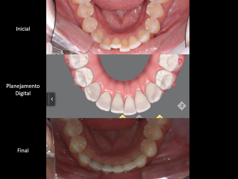 Foto 4 de Cavassin Odontologia