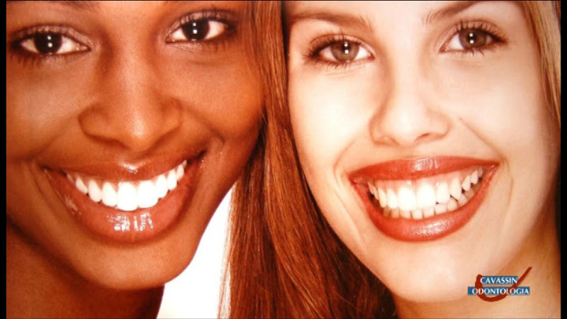 Foto 5 de Cavassin Odontologia