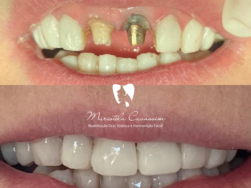 Foto 9 de Cavassin Odontologia