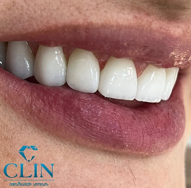Foto 2 de CClin Odontologia | Clínica Odontológica | Dentistas | Campos dos Goytacazes