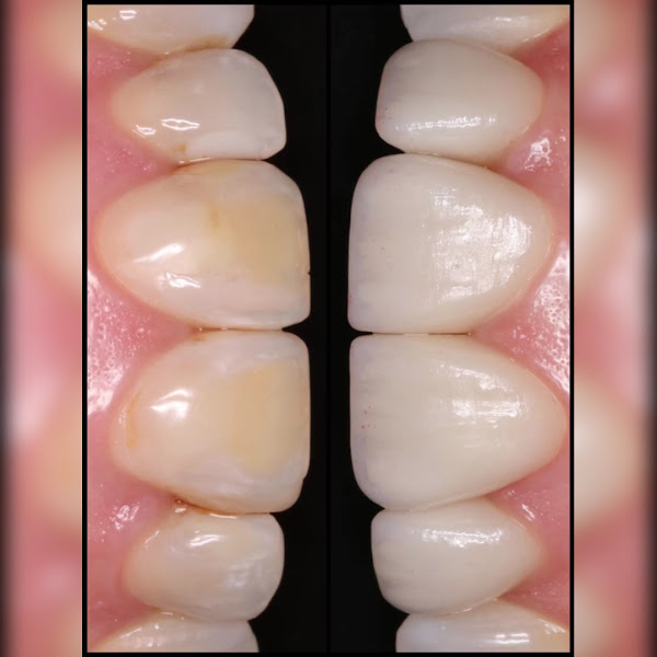 Foto 2 de CDA Sorriso | Clínica Dentária Avenida - Dentista | Implante Dentário | Invisalign