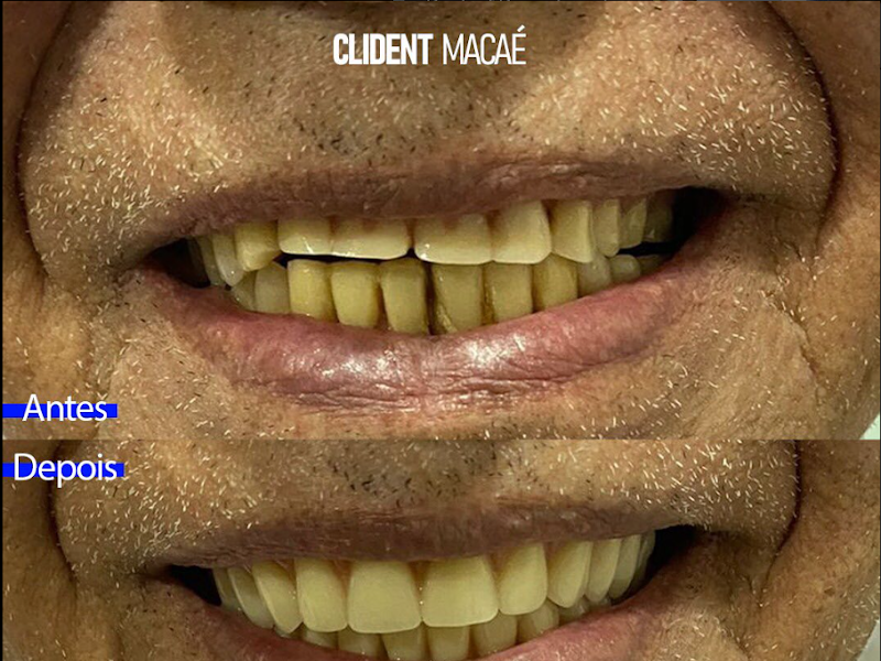 Foto 6 de Ceclim - (Centro Clínico Odontológico de Macaé)