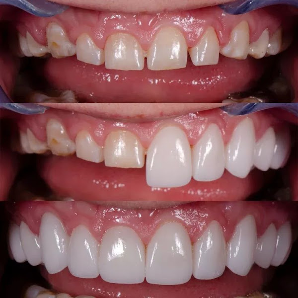 Foto 2 de Cedi Implantes