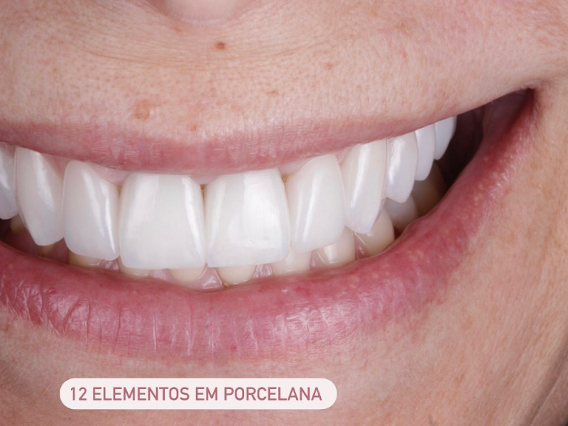 Foto 11 de Celina Lang Odontologia Especializada