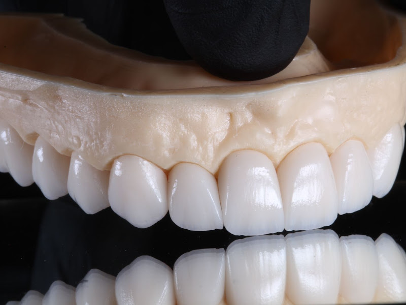 Foto de Center implantes