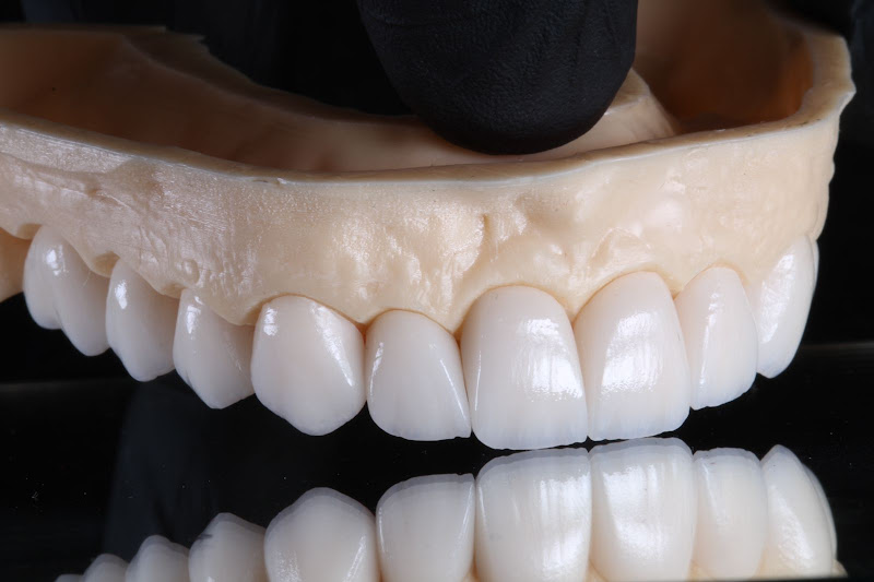 Foto 2 de Center implantes