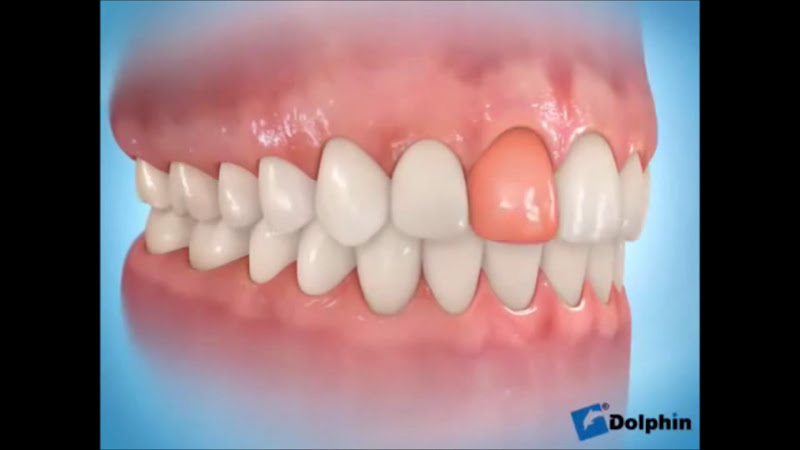 Foto 3 de Central Dente