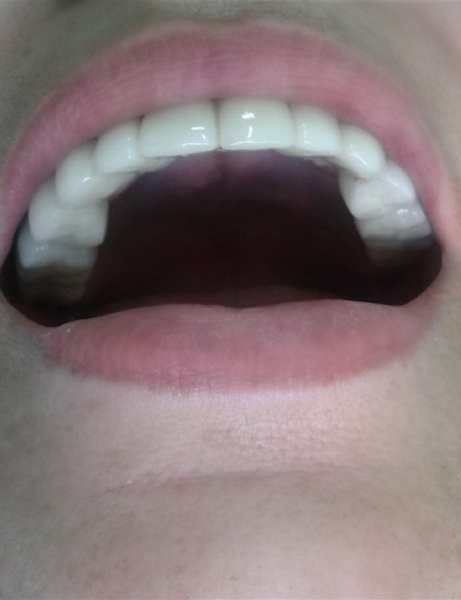 Foto 3 de Central Do Implante