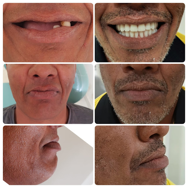 Foto 3 de Central Implantes