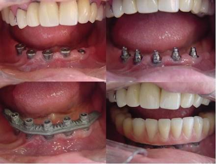 Foto 3 de CENTRE - Tratamentos Odontológicos