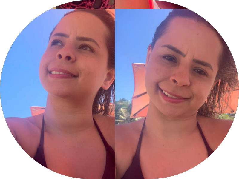 Foto 3 de Centro de Endoscopia HCF