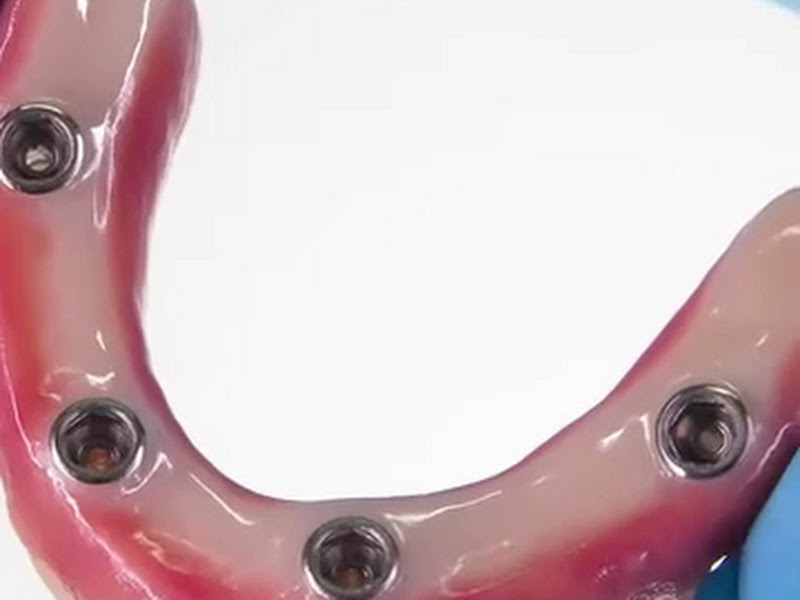 Foto 8 de Centro de Especialidades Odontológicas do Maranhão - SORRIR