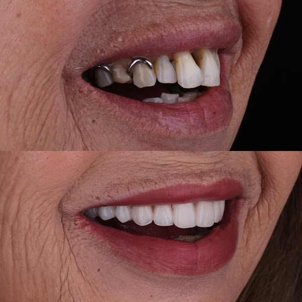 Foto 2 de CENTRO DE IMPLANTE ODONTOLOGICO DO AGRESTE - CIOA