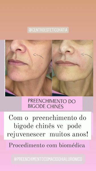 Foto 2 de Centro Estético Katia Castro