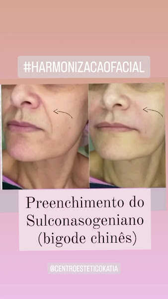 Foto 3 de Centro Estético Katia Castro