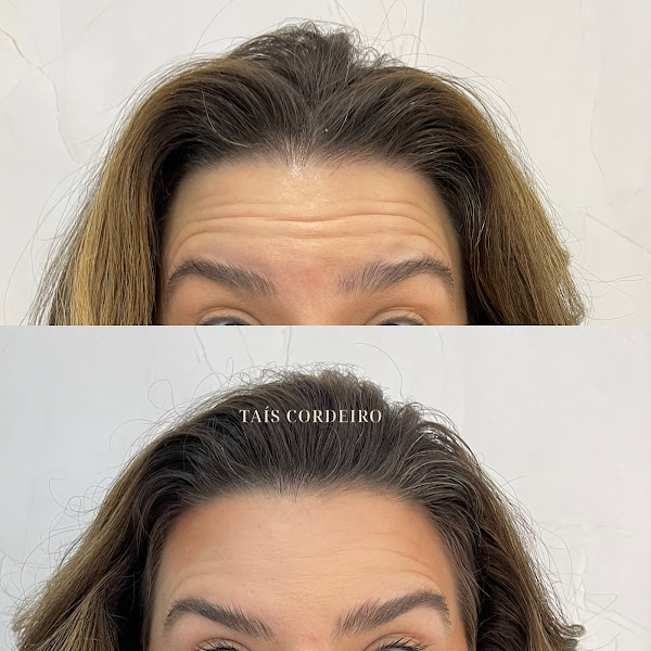 Foto 3 de Centro Estético Taís Cordeiro