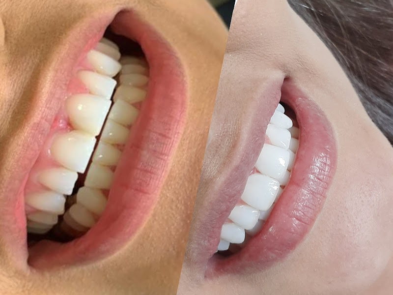 Foto 8 de Centro Lyra Odontologia Especializada