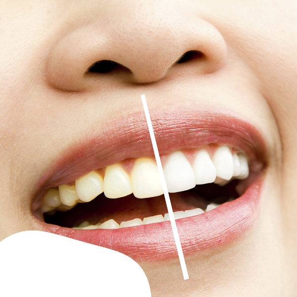 Foto 2 de Centro Odontológico Dr Willian Zunta