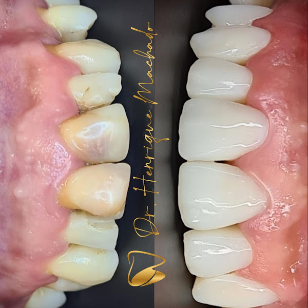 Foto 3 de Centro Odontológico Henrique Machado - Dentista em Sumaré