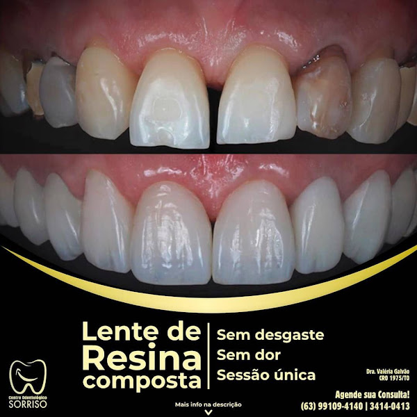 Foto 3 de Centro Odontológico Sorriso - Dr Ary Junior e Dra Valéria Galvão
