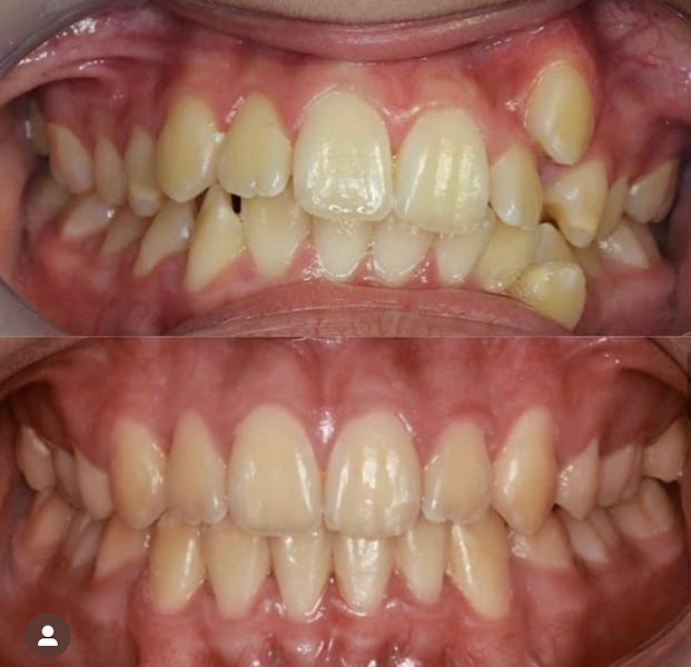 Foto 3 de Centroface