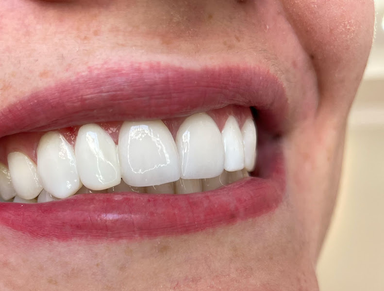 Foto 2 de CEOP - Centro Especializado em Odontologia e Prótese