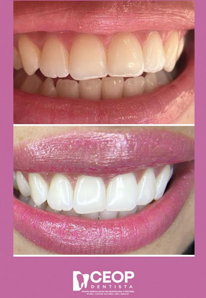 Foto 3 de CEOP - Centro Especializado em Odontologia e Prótese