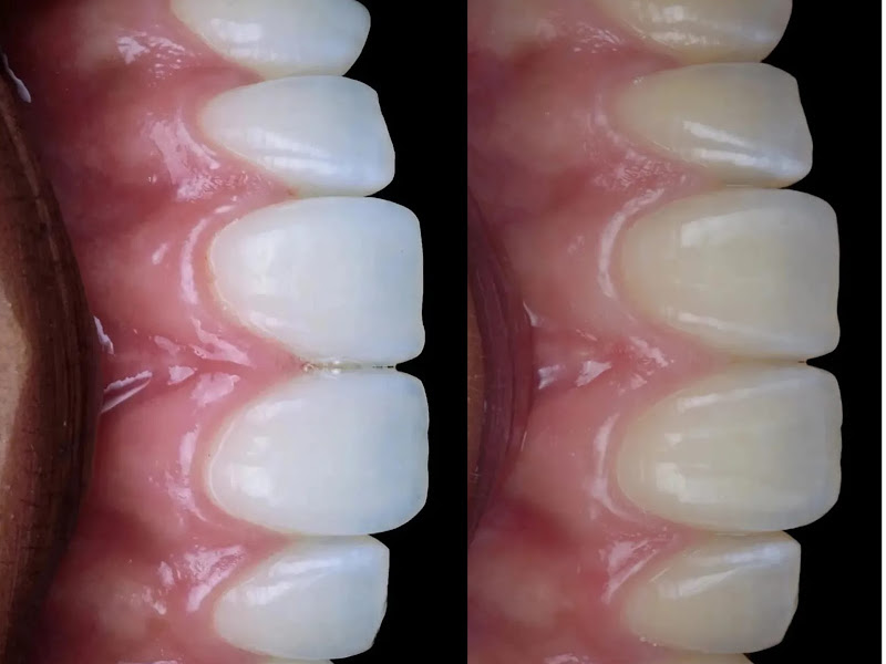 Foto 10 de CEOP Odontologia