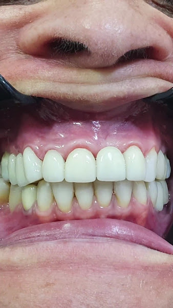 Foto 3 de CEPEN Implantes