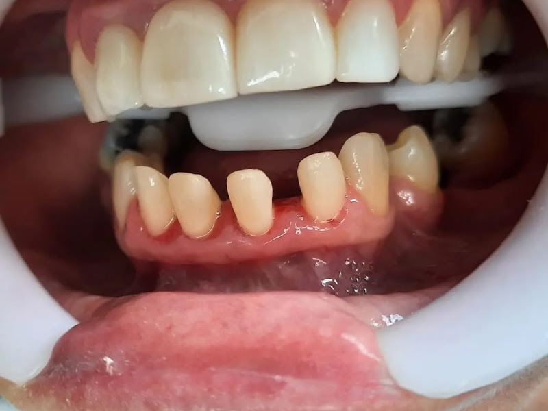 Foto 5 de Cervi Odontologia