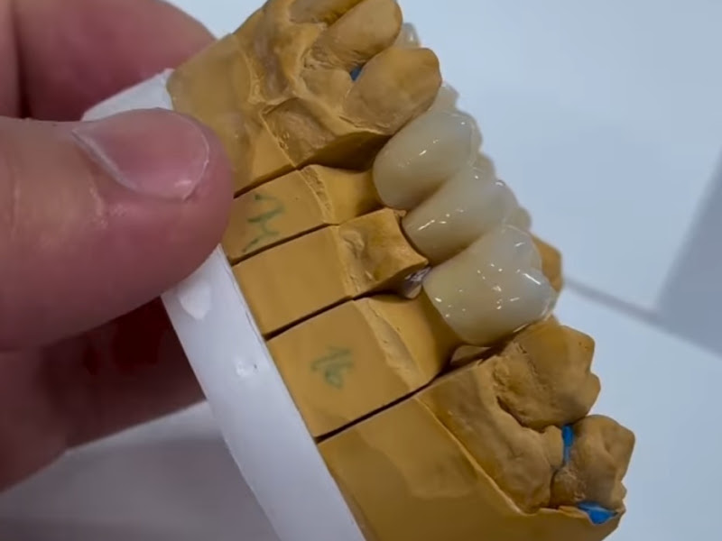 Foto 2 de Ces Serviços Odontológicos