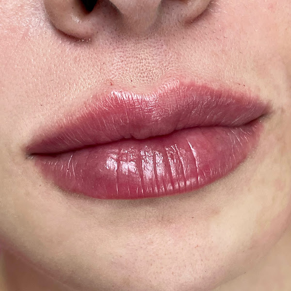 Foto 2 de Chez Clinique - Odontologia e Harmonização Facial