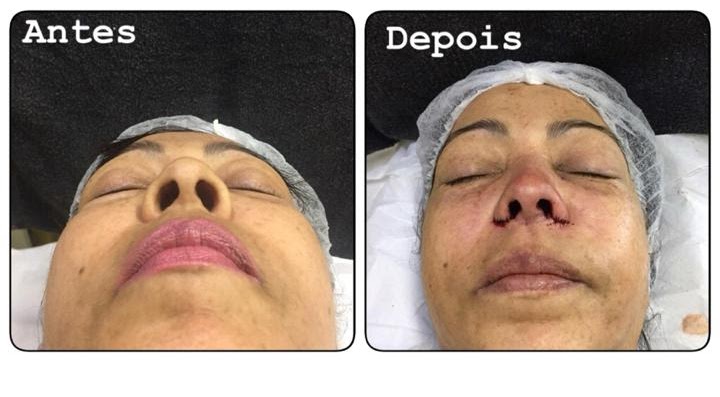 Foto 3 de Cia Da Harmonização Unidade Vilar Dos Teles