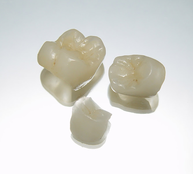 Foto 2 de CIMP - Centro de Implantodontia e Prótese