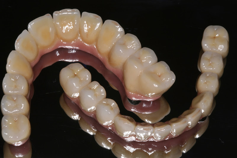 Foto 3 de CIMP - Centro de Implantodontia e Prótese