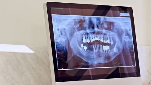 Foto 2 de CIOC Copacabana - Centro de Imagenologia Odontológica de Copacabana