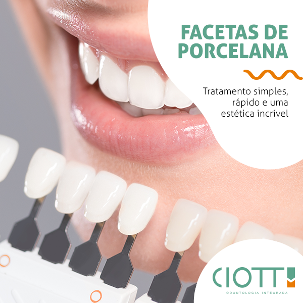 Foto 3 de Ciotti Odontologia e Invisalign Campinas