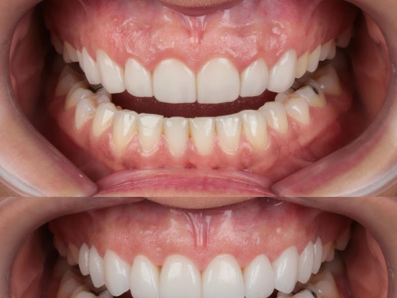 Foto 7 de CiR - Hospital Odontológico - Lentes de Contato Dental e Implantes em Brasília-DF