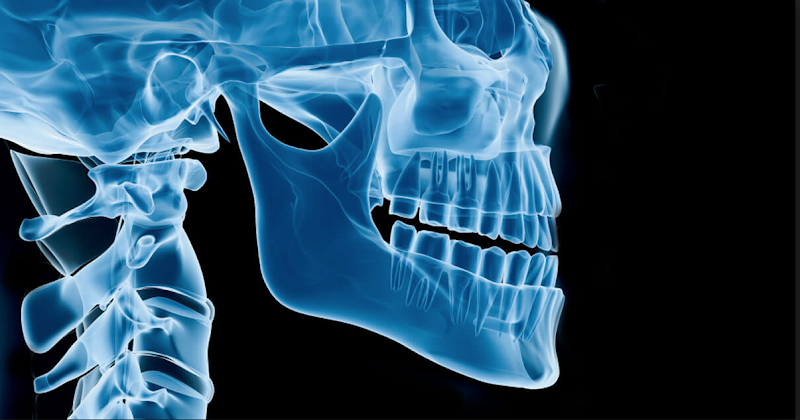 Foto 2 de Cirurgia Buco Maxilo Facial - Dr Maurício Romanowski