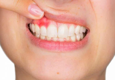 Foto 2 de Cirurgia Buco-Maxilo-Facial em Salvador | Implantes Dentários