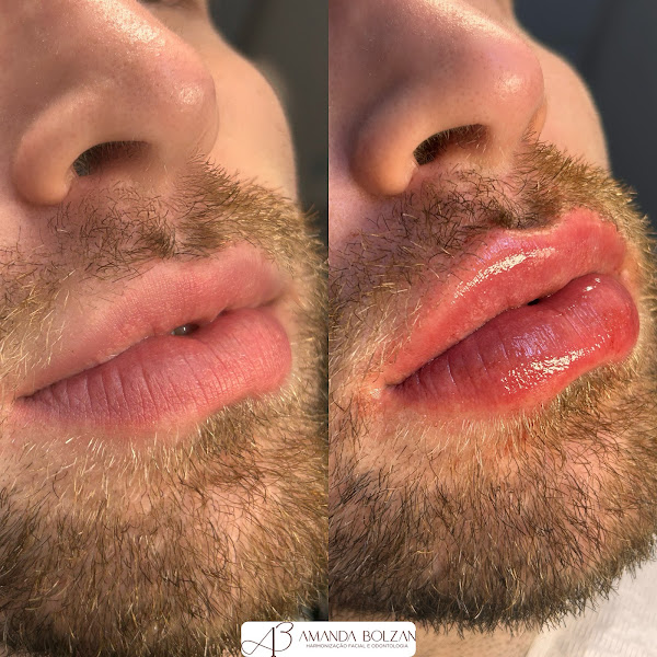 Foto 3 de Cirurgiã - Dentista Amanda Bolzan