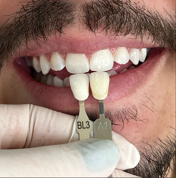 Foto 2 de Cirurgiã Dentista Brunna Taffarel