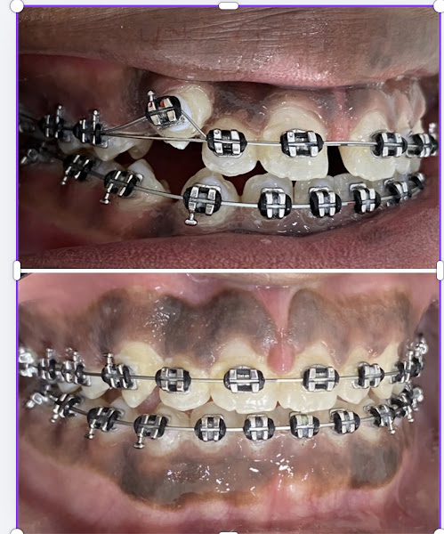 Foto 2 de Cirurgiã dentista Dra Alessandra Soares dos santos