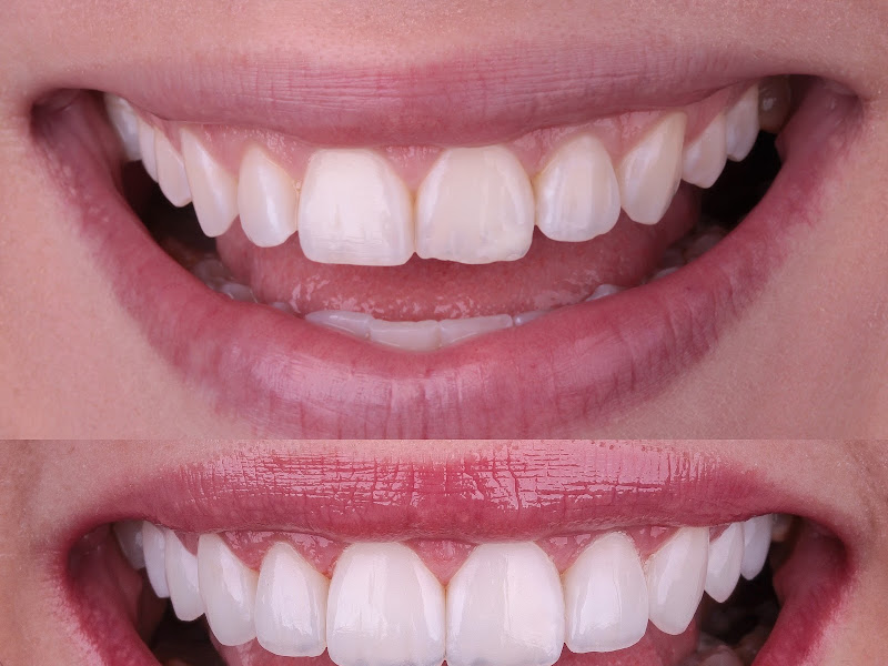 Foto 3 de Cirurgiã Dentista-Dra. Cláudia Caroline Bósio