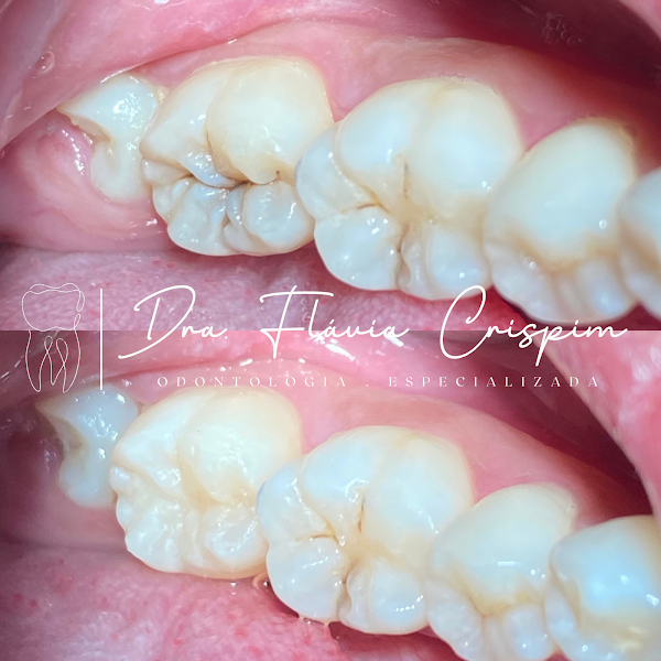 Foto 2 de Cirurgiã-Dentista Dra. Flávia Crispim