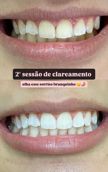 Foto 2 de Cirurgiã Dentista Dra. Poliana Dupim | Jacareí