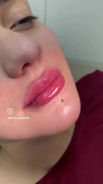 Foto 3 de Cirurgiã Dentista Dra. Poliana Dupim | Jacareí