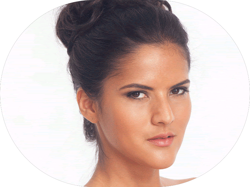 Foto 6 de Cirurgiã Dentista Dra Raquel Rosa - Reabilitação Oral