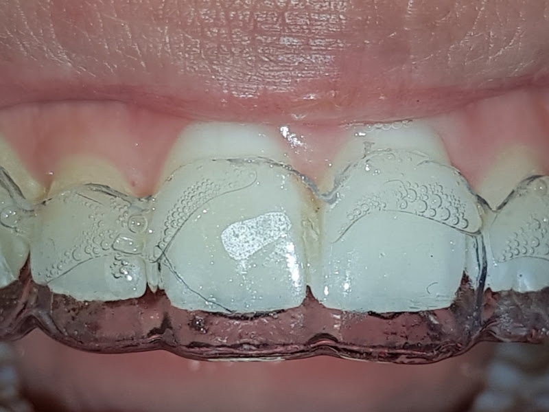 Foto 3 de Cirurgiã Dentista/Endodontista